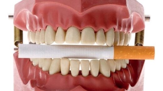 Как курение влияет на здоровье полости рта?