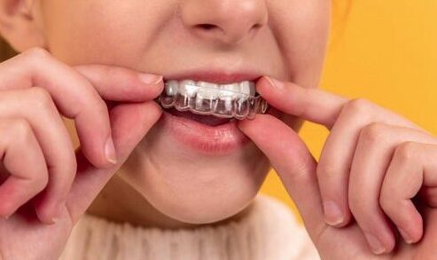 Можно ли исправить неправильный прикус с помощью системы Invisalign без хирургического вмешательства?