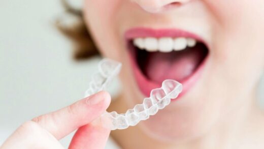 Приём пищи, речь и повседневные привычки во время лечения с помощью Invisalig
